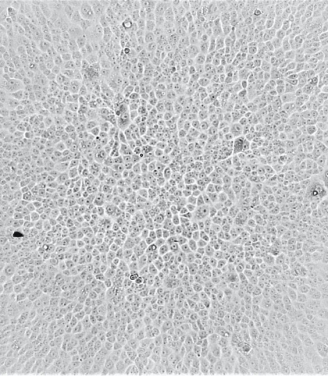 原始的SARS-CoV-2病毒在混合了Coronavac（科興）疫苗接種者的血清之後毒性大幅減弱，沒有觀察到細胞病變作用（CPE），細胞沒有死亡。